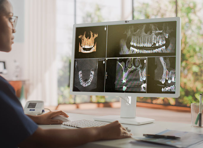 CBCT 3D software