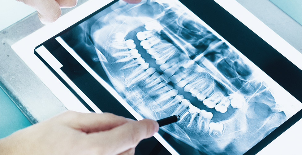 Endodontics thumbnail