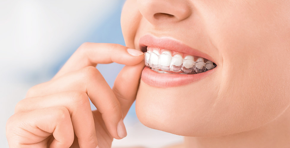 Orthodontics & Invisalign thumbnail