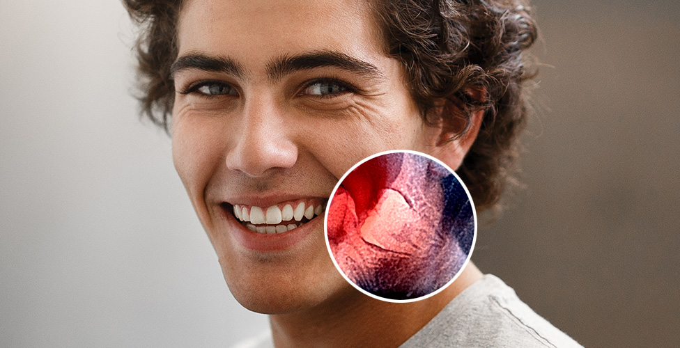 Wisdom Teeth thumbnail