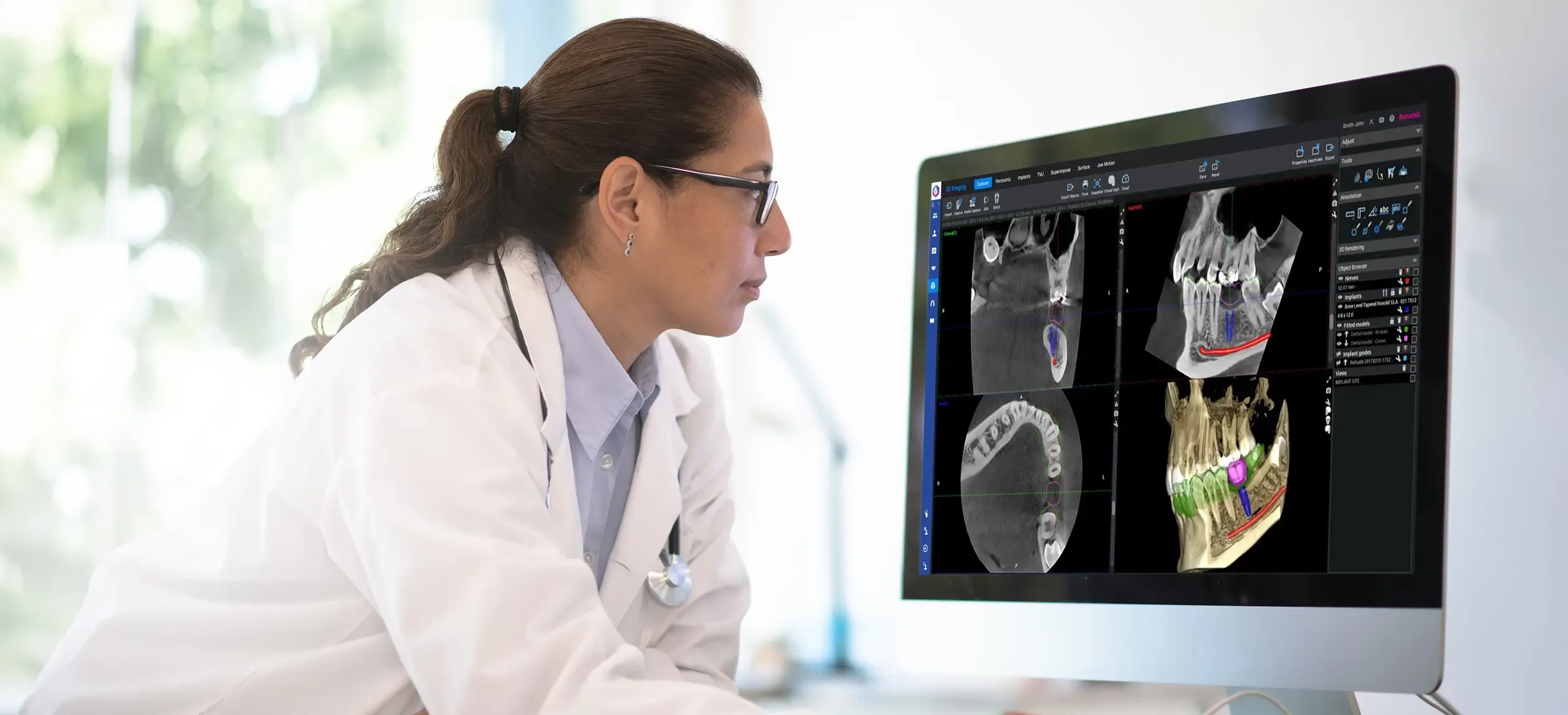 Person using CBCT software