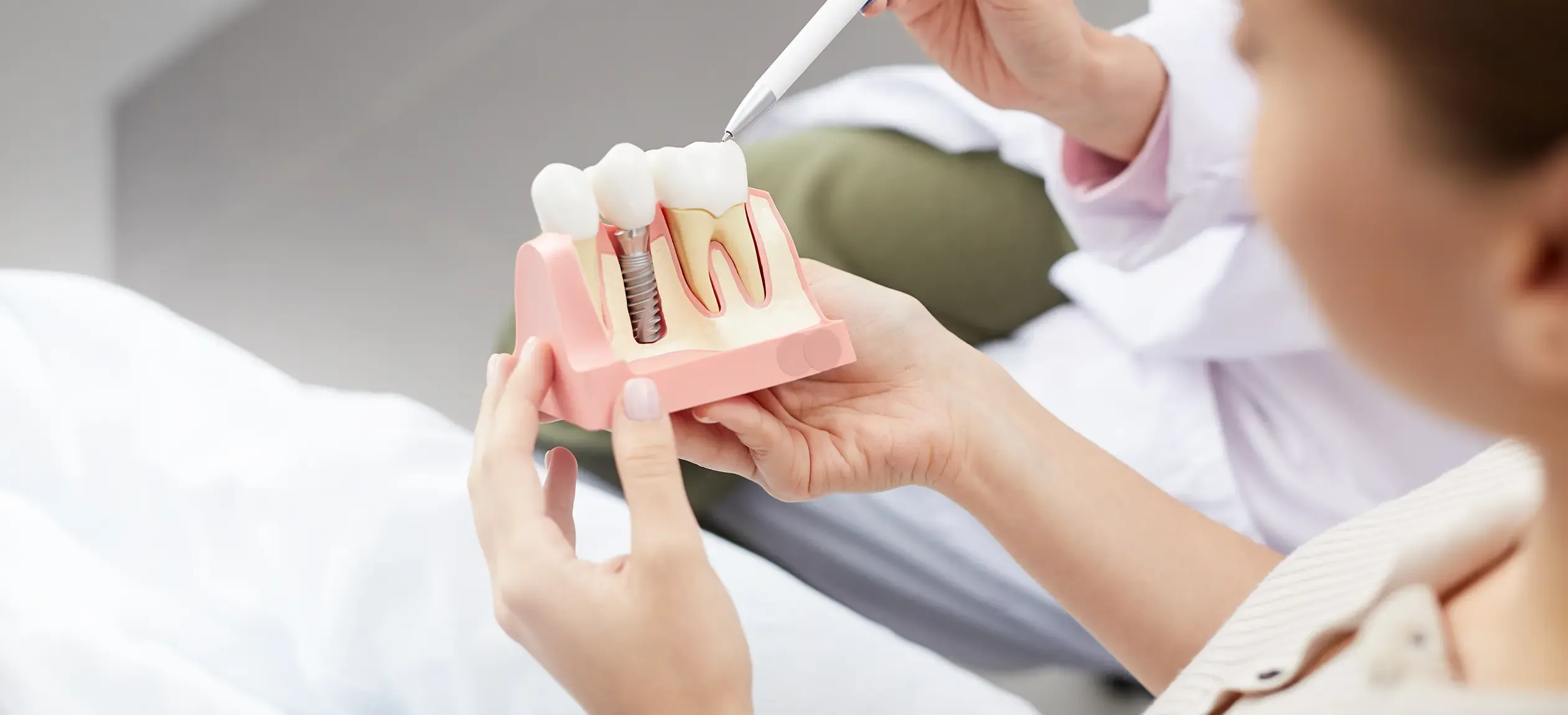 Model of dental implant